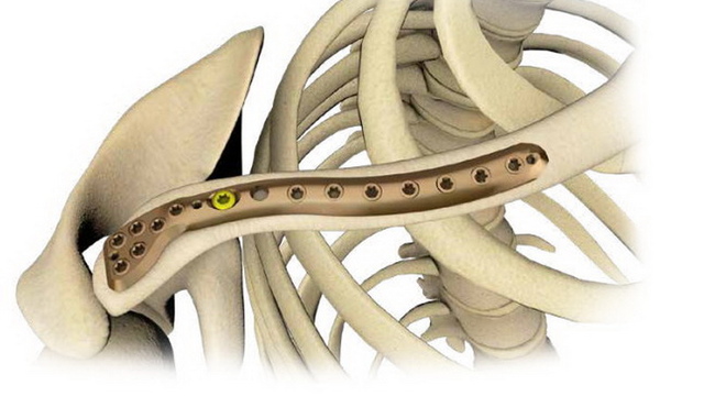 Ключица (clavicula)