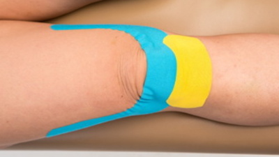 Кінезіологічне тейпування колінного суглоба
