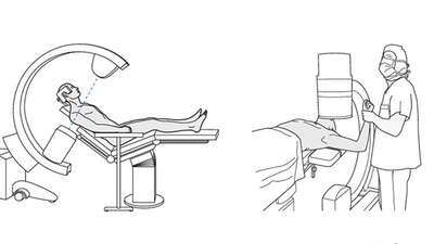 Інтраопераційна візуалізація проксимального відділу плеча