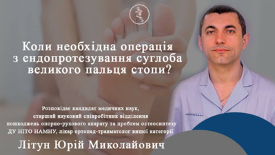 Коли необхідна операція з ендопротезування суглоба великого пальця стопи?