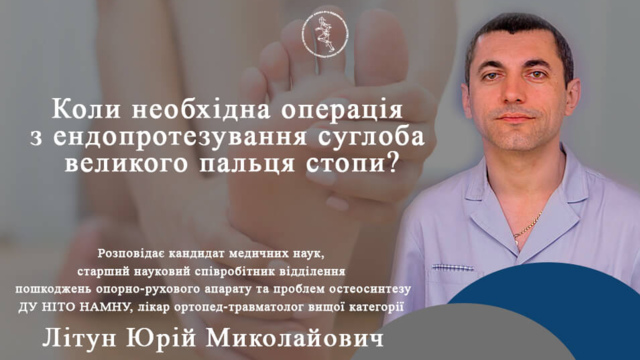 Коли необхідна операція з ендопротезування суглоба великого пальця стопи?