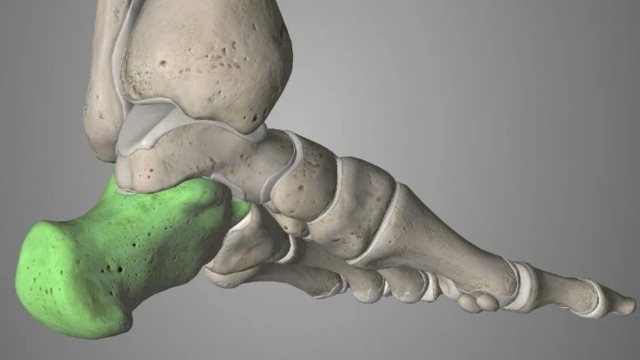 Переломи пʼяткової кістки: коли опора стопи потребує відновлення