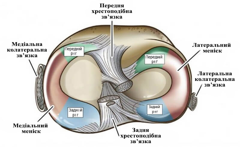 Травми та захворювання колінного суглоба. Артроскопічна меніскектомія (резекція меніска) 