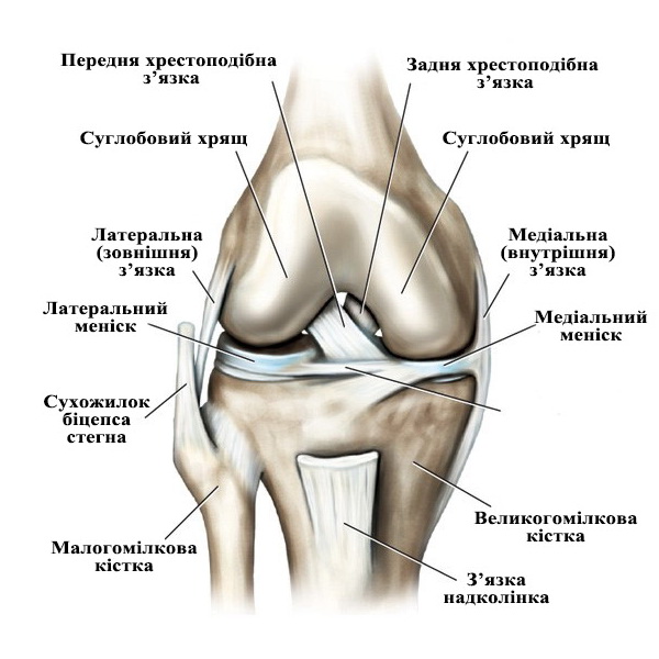 Гонартроз - деформівний (деформуючий) артроз колінного суглоба