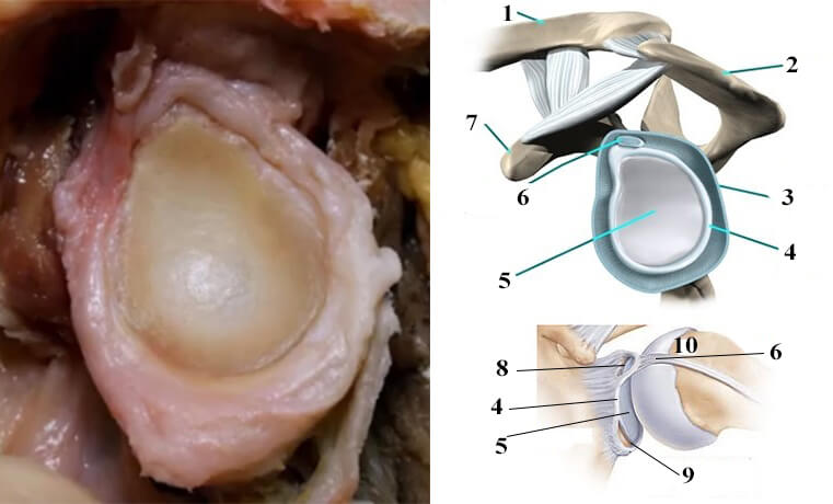 Пошкодження суглобової губи плечового суглоба – SLAP (Superior Labrum Anterior to Posterior)
