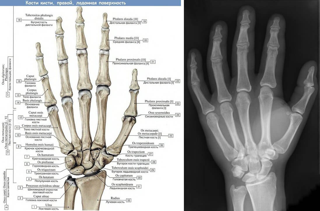 Кістки кисті поділяються на кістки зап’ястка, п’ястка та кістки, що входять до складу пальців, які називаються фаланги.