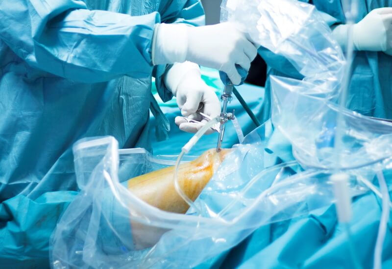 Артроскопия коленного сустава, отзывы и стоимость операции