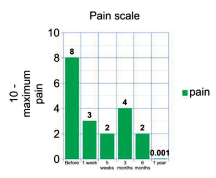 Малюнок 1. На цьому графіку показано результат травми коліна та остеоартриту (KOOS), який вимірює бал на основі уявлення пацієнта про коліно та пов’язані з ним проблеми. Ідеальний результат для KOOS – 100.