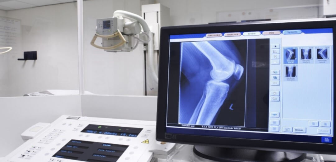 Рентгенологическая классификация и диагностика остеоартрита. Нужна ли помощь МРТ?