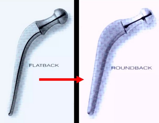 1974-75 роки. Ніжка Roundback прийшла на заміну Flatback. Це збільшило поверхню контакту метала з цементом та зменшило ризик пошкодження мантії кутами ніжки.