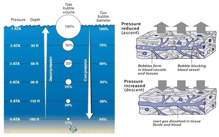 Fig 2. Ілюстрація процесу утворення бульбашок у водолазів; іншим зображенням може бути пляшка газованої води. Пляшка газованої води наповнена газом (вуглекислим газом), який не видно, оскільки він розчинений у розчині під тиском. Коли пляшку відкривають, тиск скидається, і газ виходить з розчину у вигляді бульбашок. Повернення водолаза на поверхню схоже на відкриття пляшки газованої води. Коли водолаз підпливає до поверхні, тиск знижується. Азот, який розчинився в тканинах, знову хоче вийти, оскільки організм може утримувати лише певну його кількість. Якщо водолаз виринає на поверхню занадто швидко, надлишок азоту швидко вийде у вигляді газових бульбашок. Залежно від того, які органи уражені, ці бульбашки викликають симптоми декомпресійної хвороби і навіть смерть.