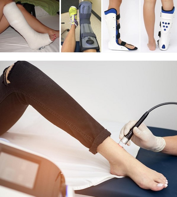 Переломи таранної кістки: сучасні аспекти діагностики та лікування