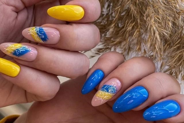 Пошкодження сухожилків розгиначів пальців кисті на рівні дистальної фаланги