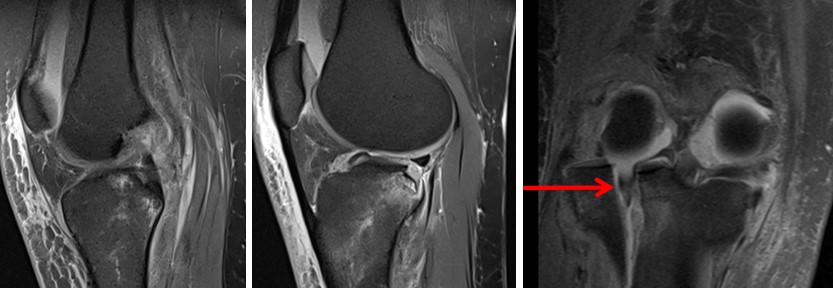 Магнітно-резонансна томографія