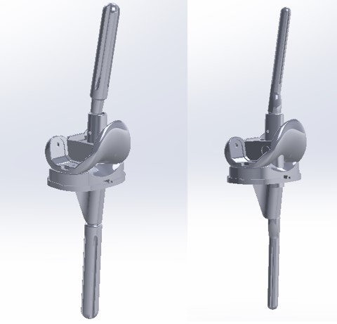 Fig. 3. 3D model of revision standard and individual knee prostheses