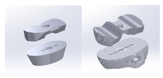 Fig. 4. Standard and custom knee augmentation