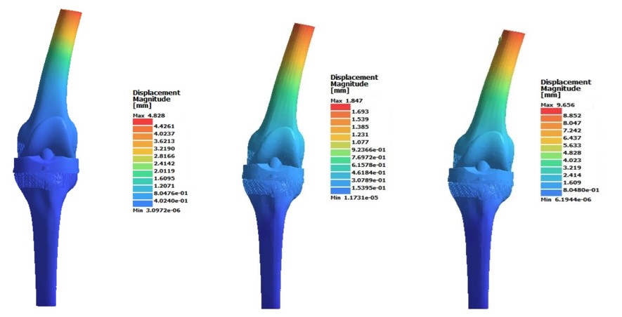 Fig. 5. Movement (displacement) of bone tissue and components of a custom implant