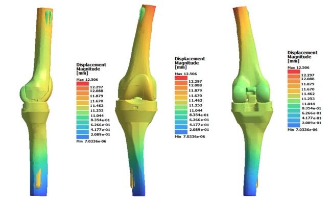 Fig. 10. Movement (displacement) of bone tissue and components of a standard implant