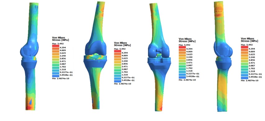Fig. 11. Tension of a standard prosthesis when applying a mass of 90 kg