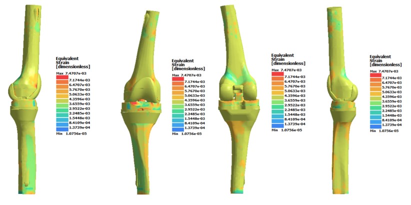 Fig. 12. Deformation of a standard prosthesis when applying a mass of 90 kg