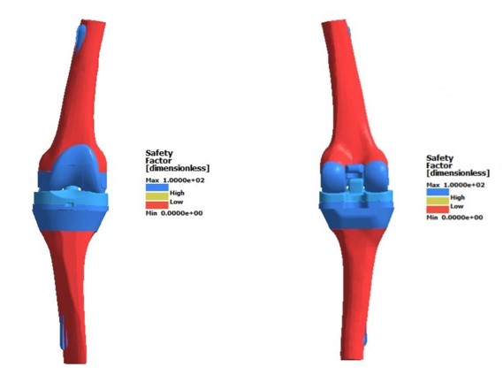 Fig. 13. Safety margin of the prosthetic knee joint