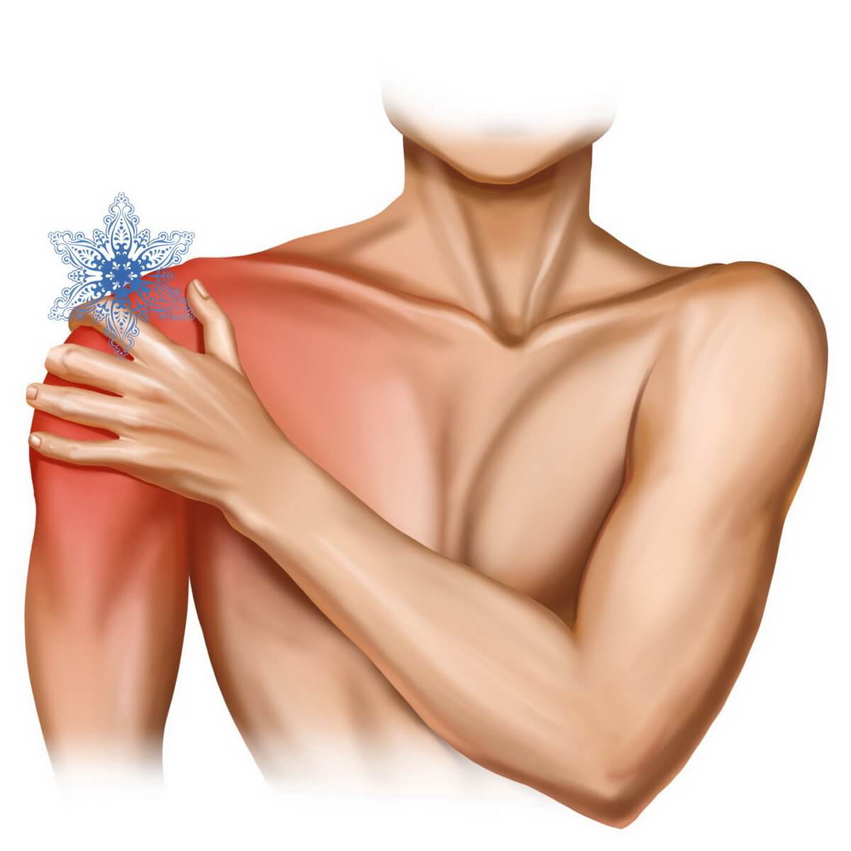 Синдром замороженного плеча