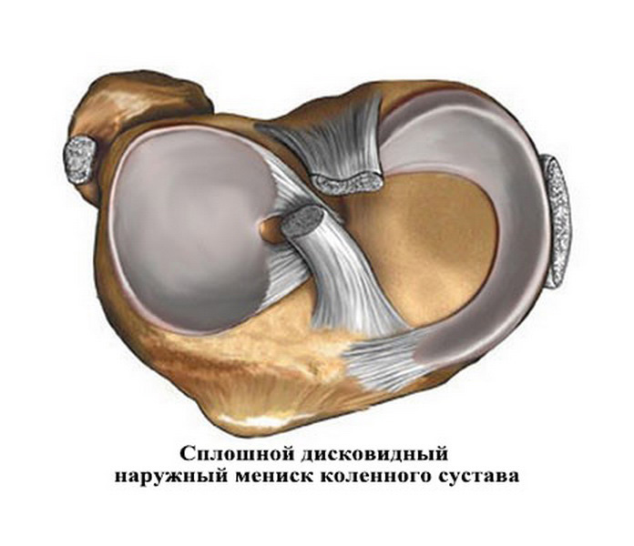 Реабилитация после артроскопии коленного сустава