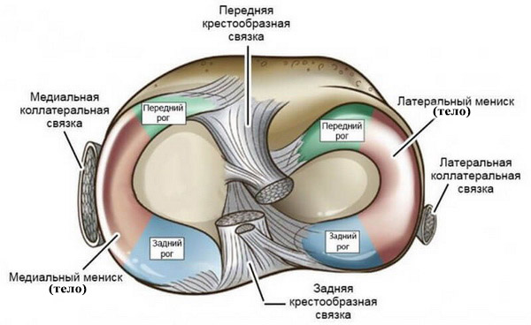 Травмы и заболевания коленного сустава Артроскопическая менискэктомия (резекция мениска)