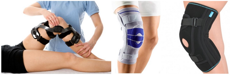 Травмы коленного сустава – причины, симптомы, диагностика и лечение | «СМ-Клиника»