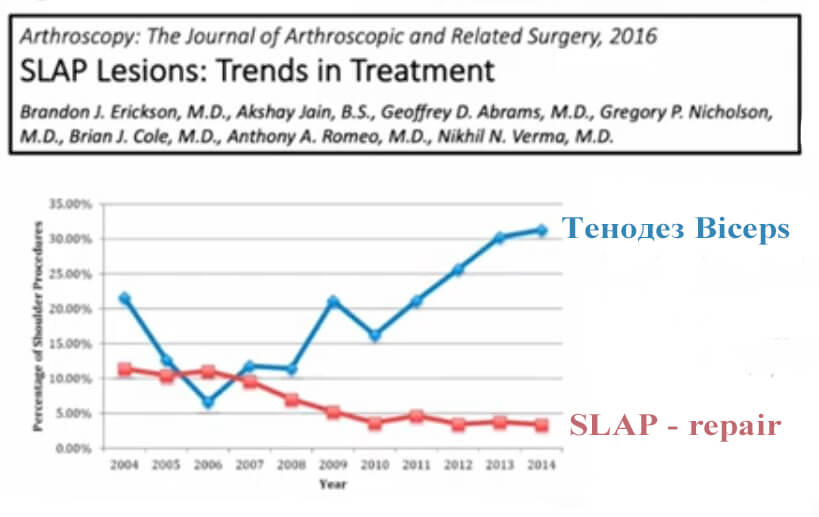 Современный тренд в лечении SLAP – снижение числа реинсерций и увеличение числа тенодезов 