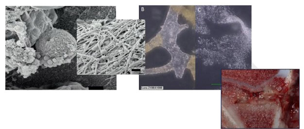 Развитие бактериальной биопленки на костной ткани