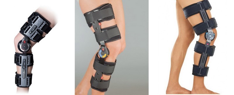 Для стабилизации биомеханики движения рекомендуют использовать специальные ортезы с фиксацией объема движений, а также индивидуальные ортопедические стельки или обувь