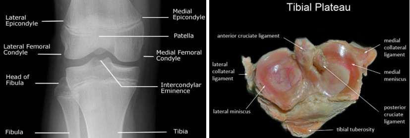 Медіальний виросток, латеральний виросток, міжвиросткове підвищення, м’якотканинні структури (колатеральні зв’язки, ПЗХ, ЗХЗ, меніски